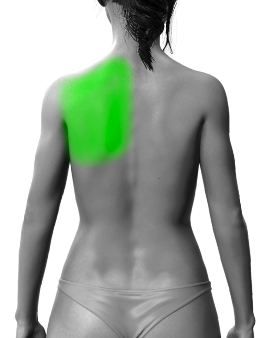 Partial Back or Shoulder