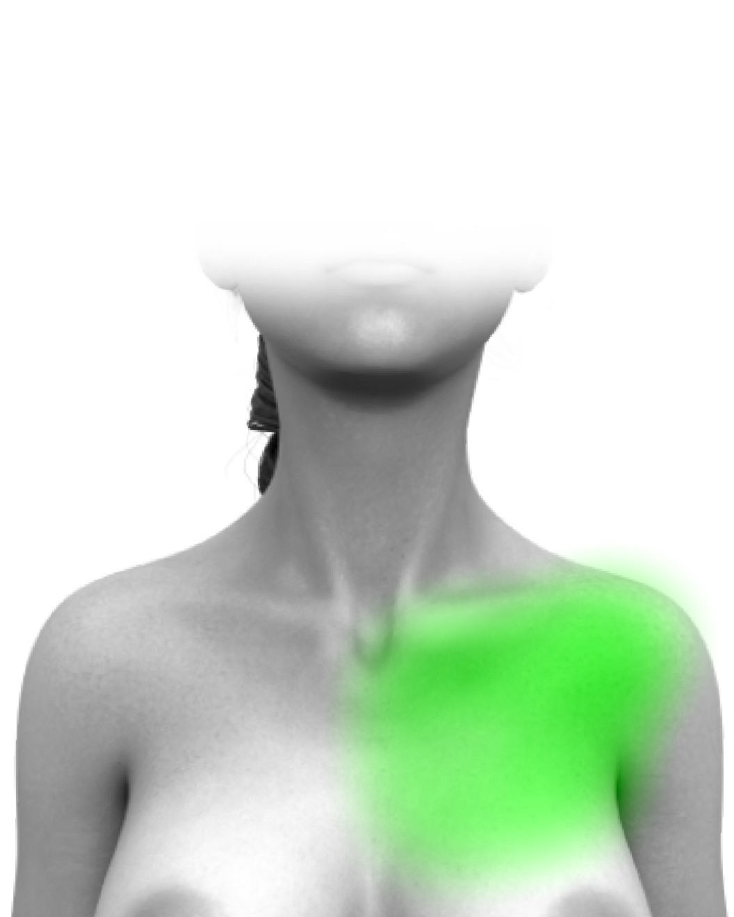 Partial Chest
