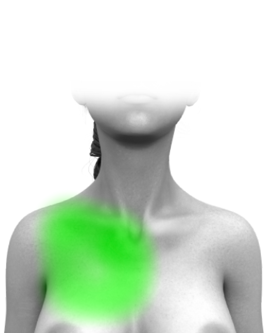 Partial Chest