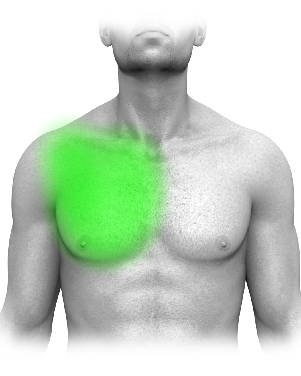 Partial Chest